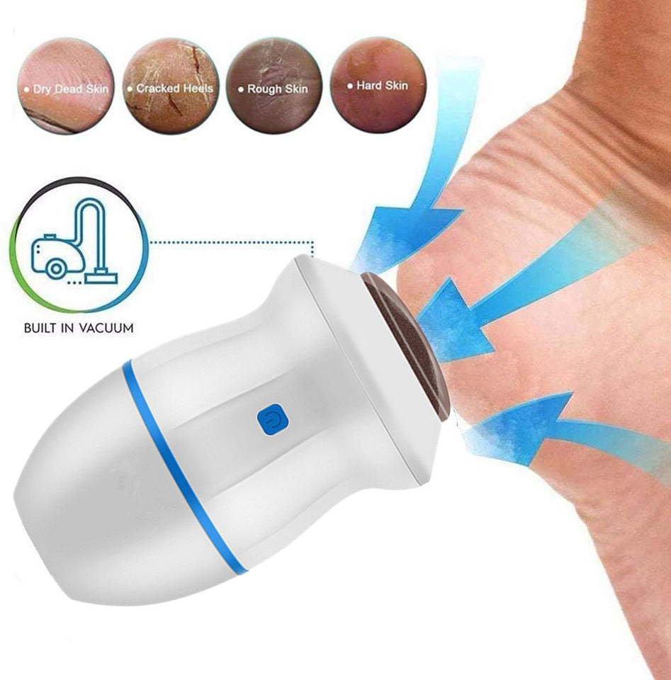 BigBuy Brand - Electric Vacuum Foot Grinder  Dead Skin Callus Remover.