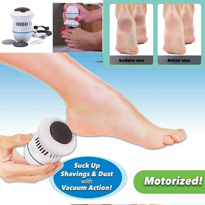 BigBuy Brand - Electric Vacuum Foot Grinder  Dead Skin Callus Remover.